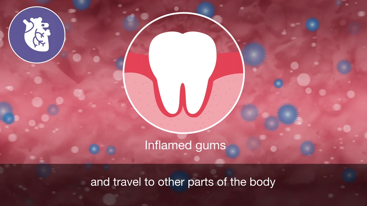 Oral and general health animation