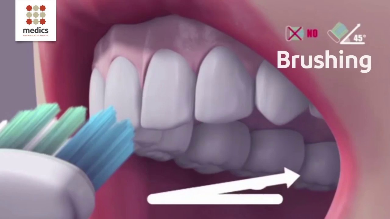 Teeth Cleaning Tips: How to Brush Your Teeth Properly
