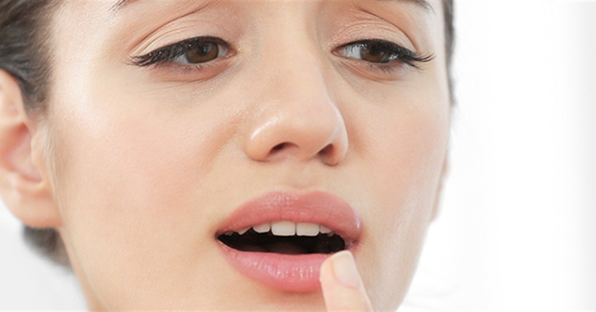 Burning mouth syndrome | Oral Health Foundation