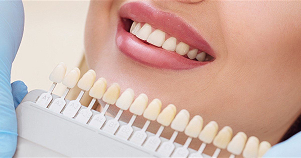 Oral health facts & tips: Tooth whitening