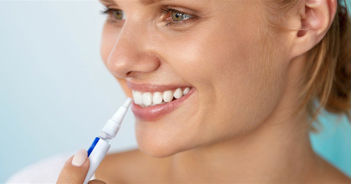 Why you need to be wary of home tooth whitening kits