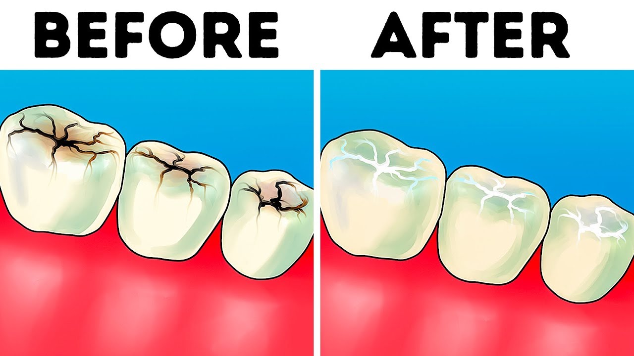 8 Easy Ways to Make Your Teeth Whiter at Home