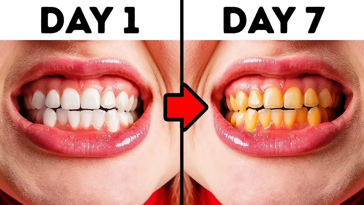10 Mistakes You Make While Taking Care of Your Teeth