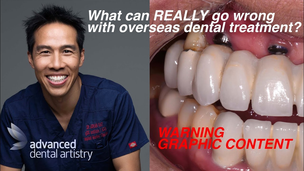 Failed Dental Implants - Overseas Dental Treatment vs Australia [WARNING Graphic Content]