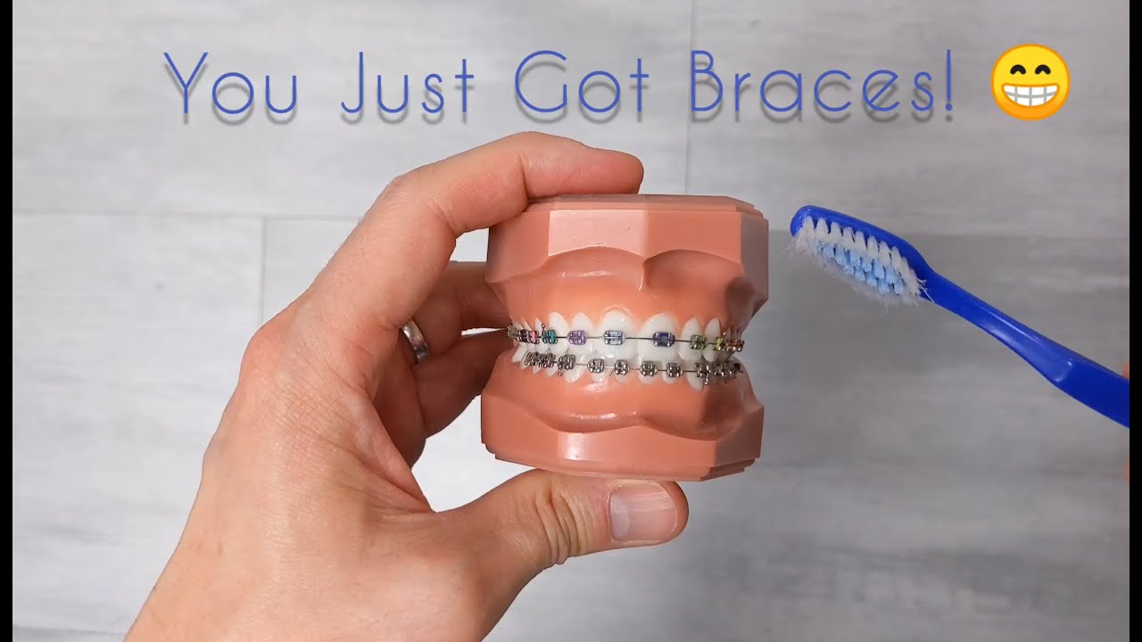 How to care for your new braces and your teeth!