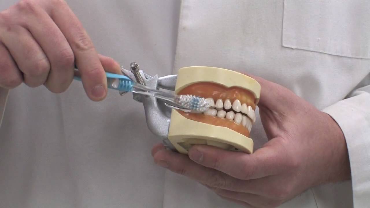 Dental Care for Teeth & Gums : How to Brush Your Teeth