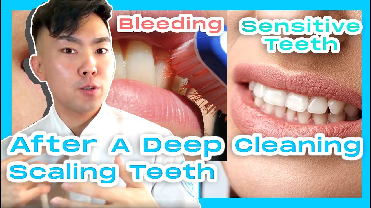 What To Do After A Deep Cleaning, Scaling Teeth, Root Planing ?