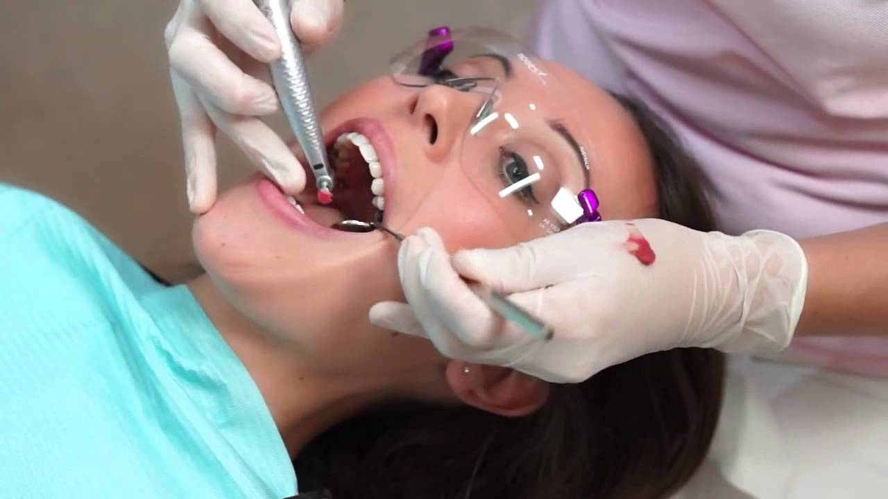 Hygienist Visit, Full Mouth Dental Cleaning