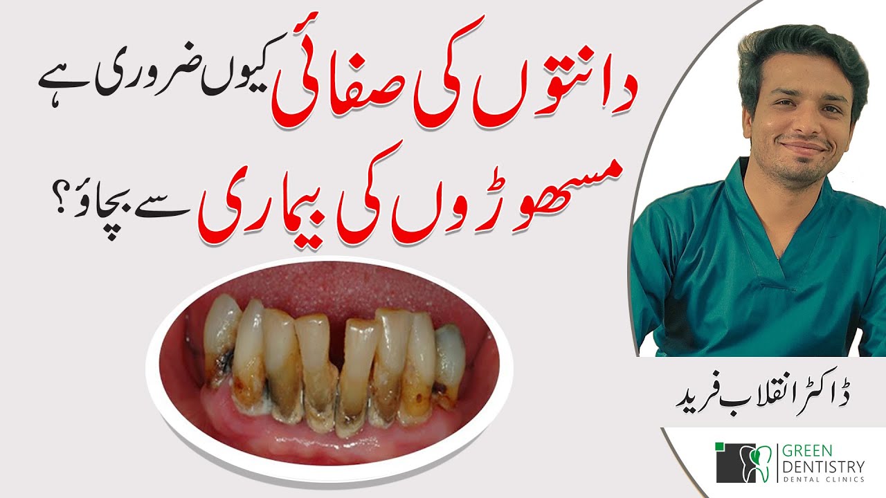 Importance of Teeth Cleaning/ Dental Scaling | Gum Disease and its Treatment | Dr. Inqalab Fareed