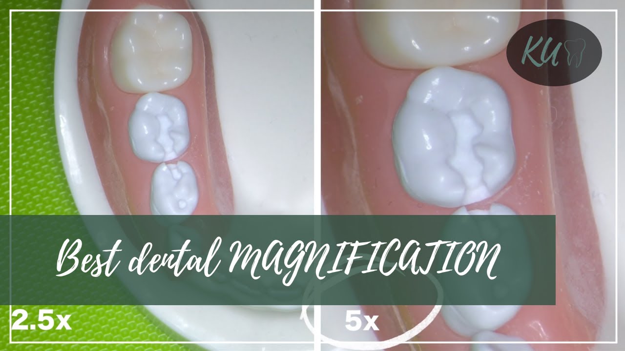 What is the IDEAL MAGNIFICATION in dentistry?