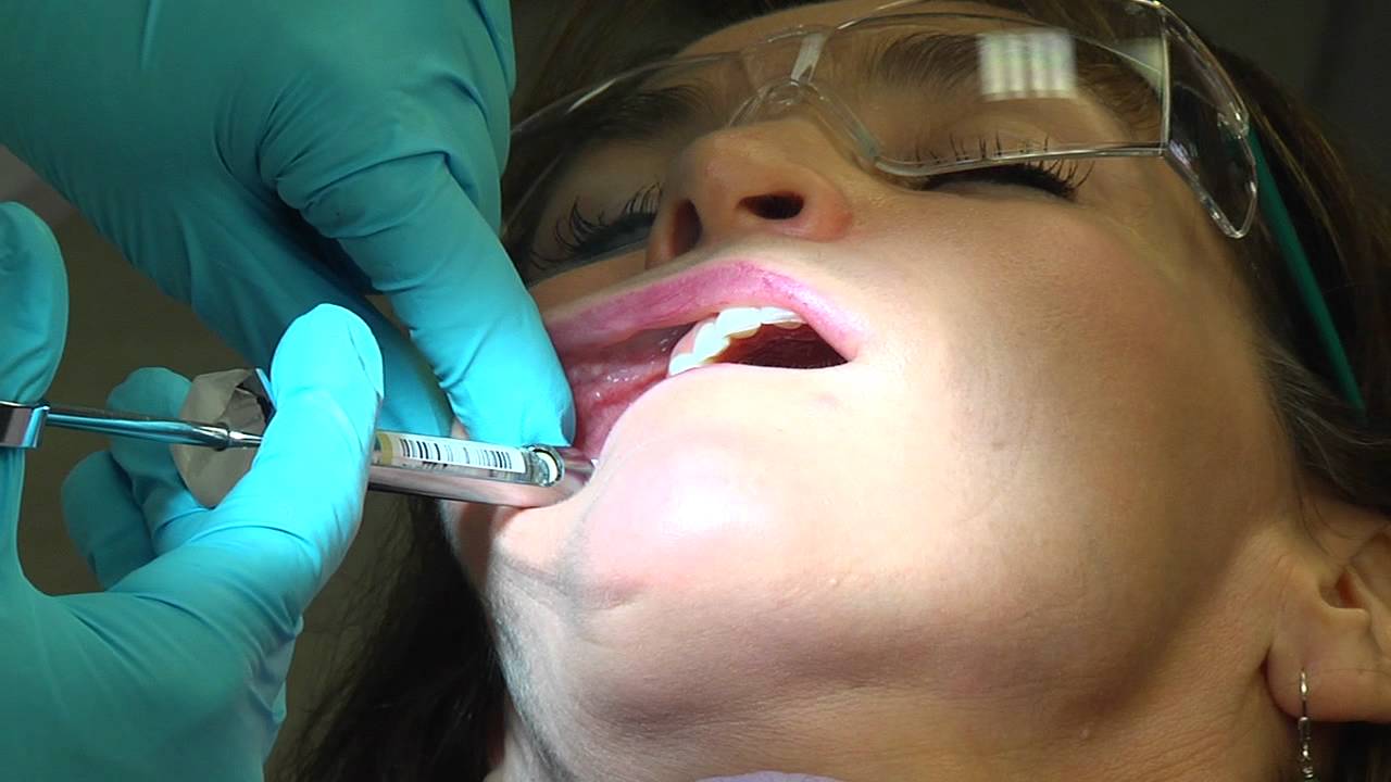 Dental Hygiene Local Anesthesia 2011