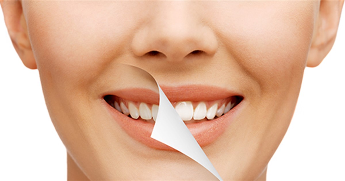 Teeth Whitening: Does it work and is it safe?