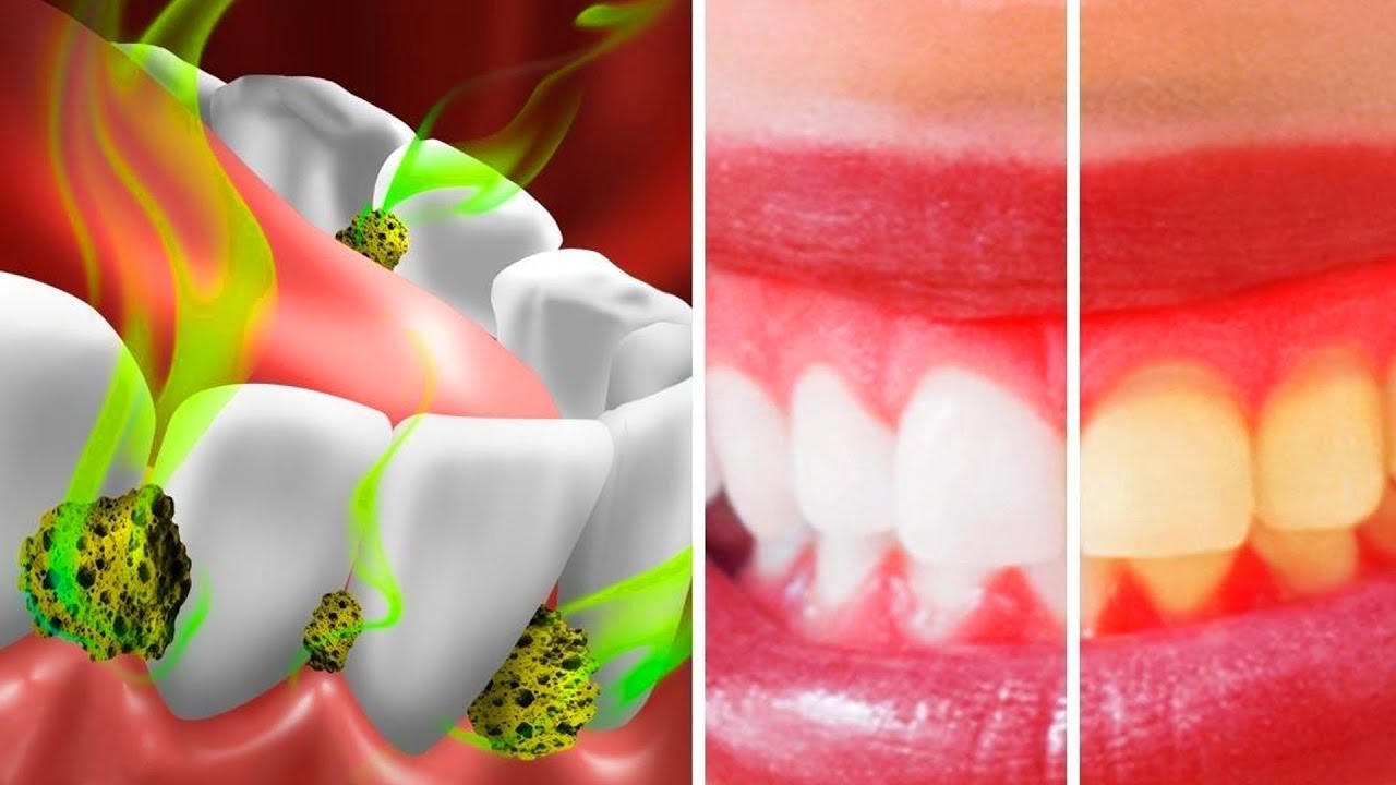 20 TRICKS TO TAKE CARE OF YOUR TEETH AND MOUTH