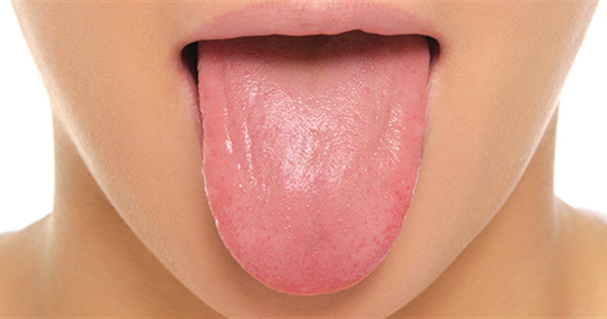 Facts and Tips: Dry mouth
