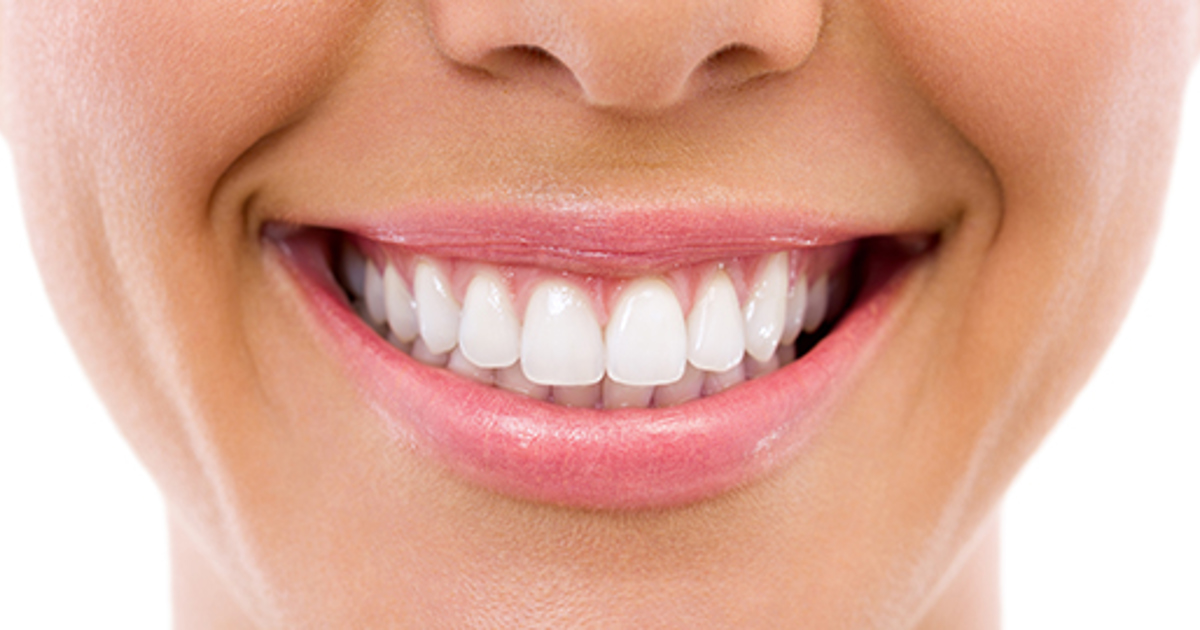 Implants and veneers top list of nation's oral health questions