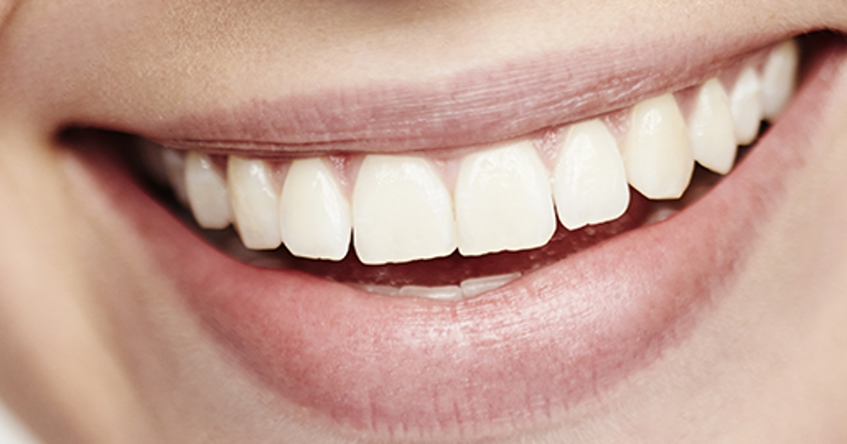 Increased fines prove that illegal tooth whitening does not pay